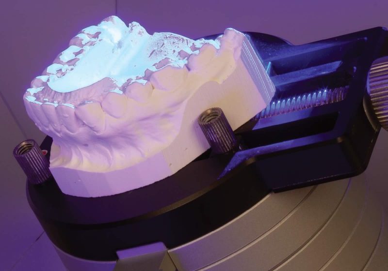 3D dental scan