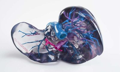 3D Printed Liver Medical Model