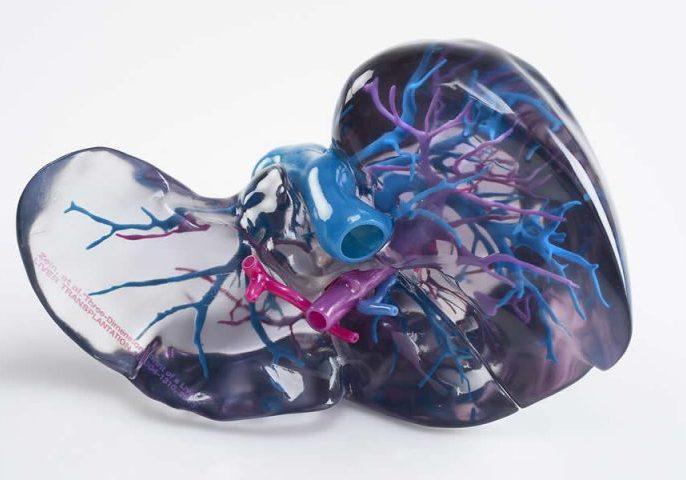 3D Printed Liver Medical Model