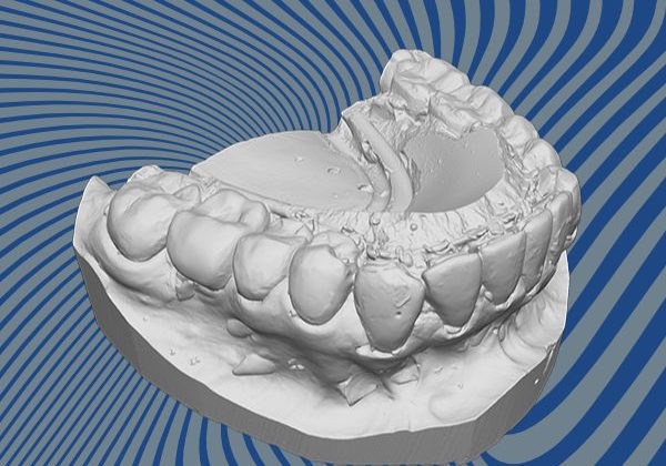 Teeth 3D scan